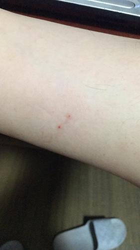 大家看看这是狗咬的伤口吗?