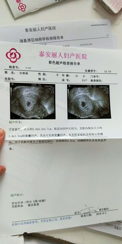今天检查的结果宫腔积血没事吧