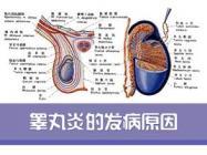 有那么一部分的男性出现睾丸萎缩这种疾病,其实就是自己的睾丸变小了