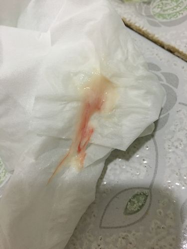 白带有血,附白带图,介意慎入!排卵试纸是否有变化