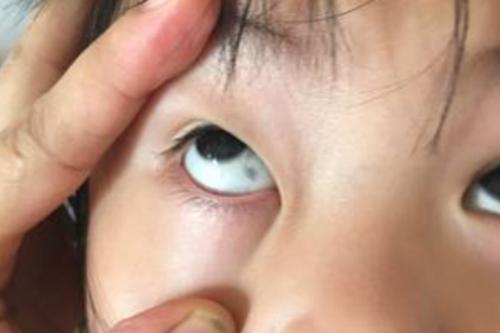大多是这3种原因作祟,早知道早
