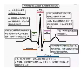医师资格实践技能心电图记忆口诀考生速记