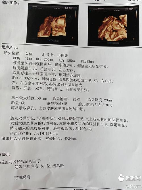 接四维彩超啦 22周 5 男宝一枚