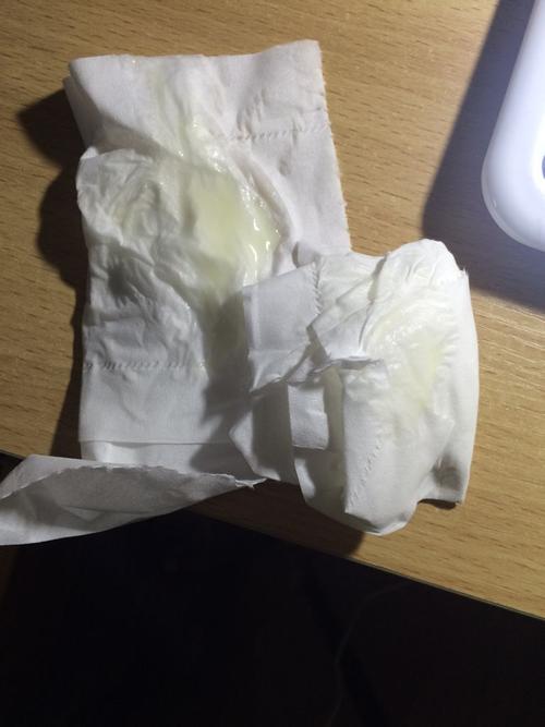 这样的白带正常吗