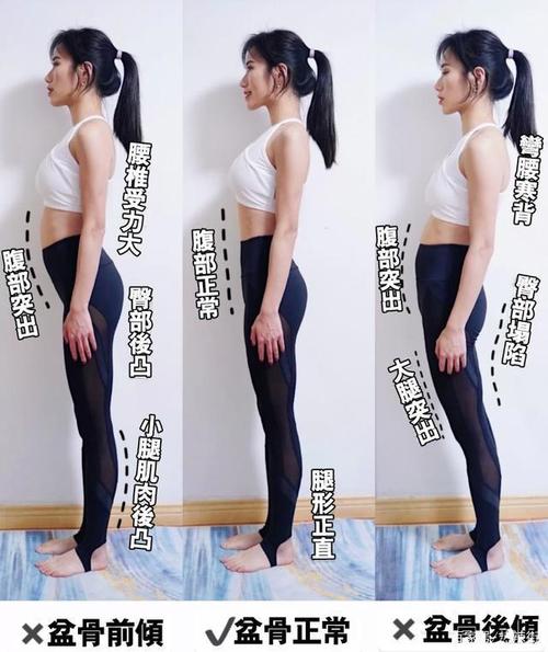 5个盆骨前倾矫正动作,改善腰痛,肚腩及大腿突出体态