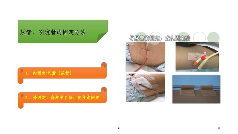 引流管的固定与护理.ppt