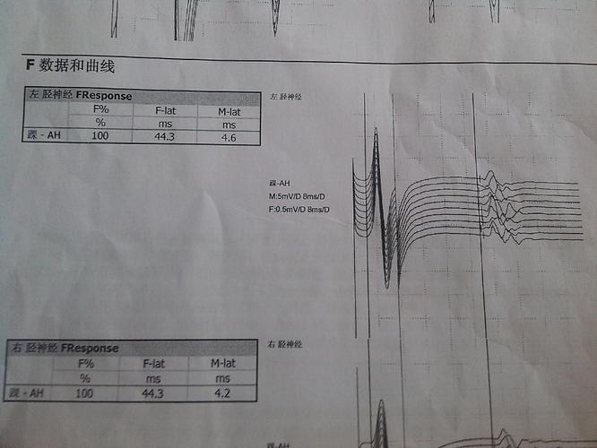 腓总神经损伤如何治疗及恢复?