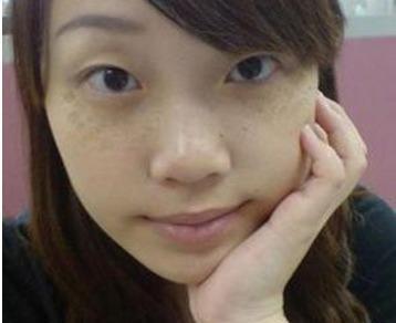 脸上长斑很显老, 睡前用不值钱的它敷面膜, 淡化斑点年轻十几岁