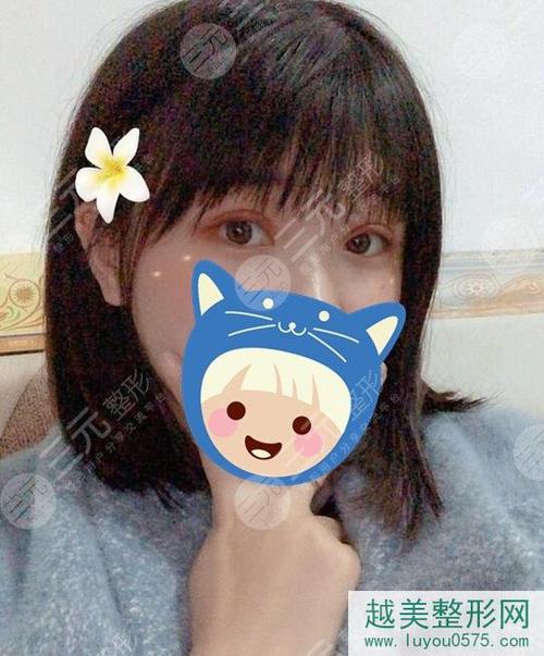 北京协和医院整形科价目表专家介绍电话