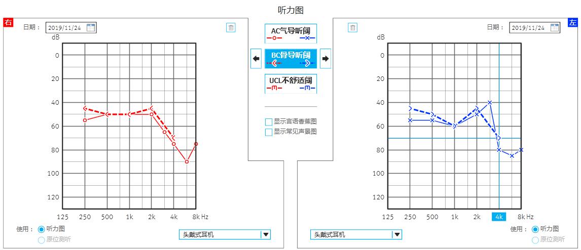纯音测听图如下