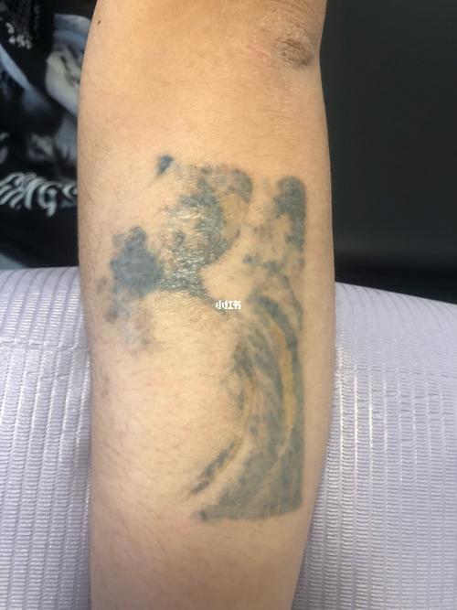 彩色纹身第一次洗后恢复记录_纹身_洗纹身_美妆_彩妆