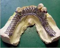 增加和外形的改变 2),舌板上缘应与牙齿舌隆突上方表面的自然曲度一致