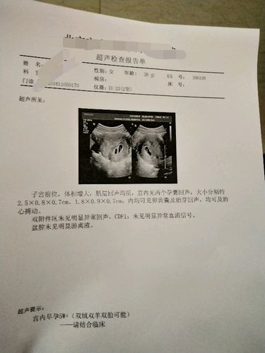 有没有有经验的,帮忙看看是都有龙凤胎的可能