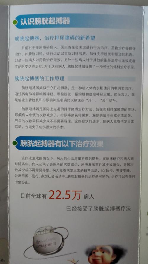 膀胱起搏器介绍