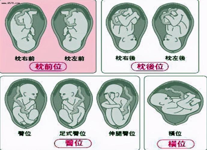 宝宝胎位是左枕前位,相当于拿到"顺产通行证",生孩子不用遭罪