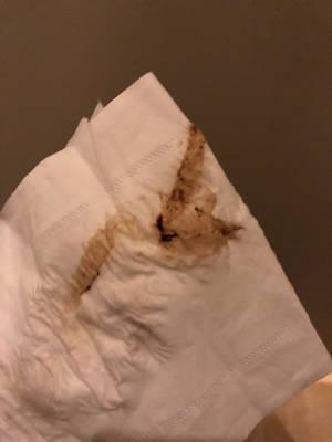 请问各位美宝妈们 是否出现类似的褐色分泌物 请问这是什麼 有没有大