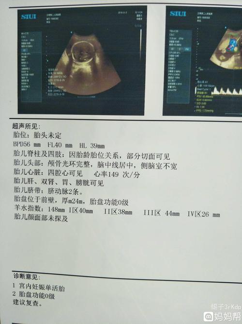 猜猜我怀的是男宝还是女宝