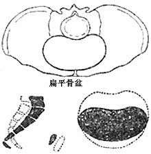 骶耻外径 b.对角径 c.耻骨弓角度 d.坐骨棘间径 e.坐骨