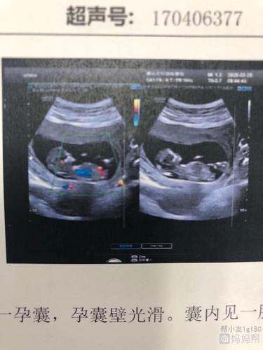 nt图 圆鼓鼓小肚子哈哈