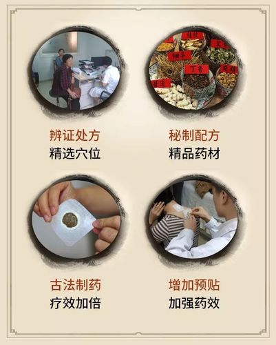 深圳五洲医院2005年就开始开展三九贴贴敷服务,迄今已有十二年历史