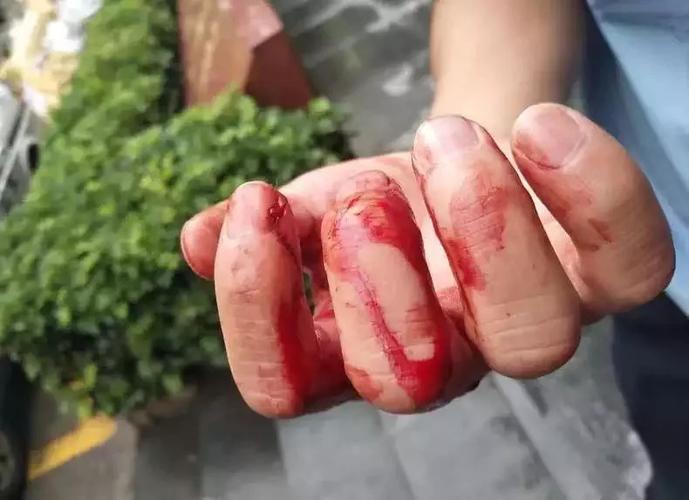 温州外卖小哥手持剪刀抵制脖子企图自残,危急关头民警