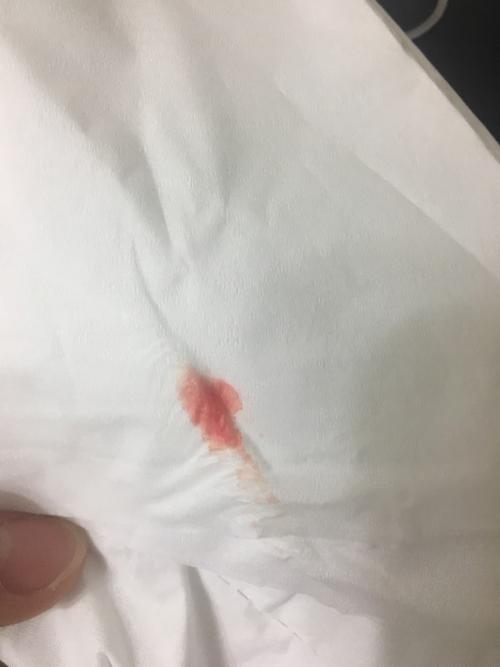 月经早了四天来,究竟是着床出血还是排卵期出血?