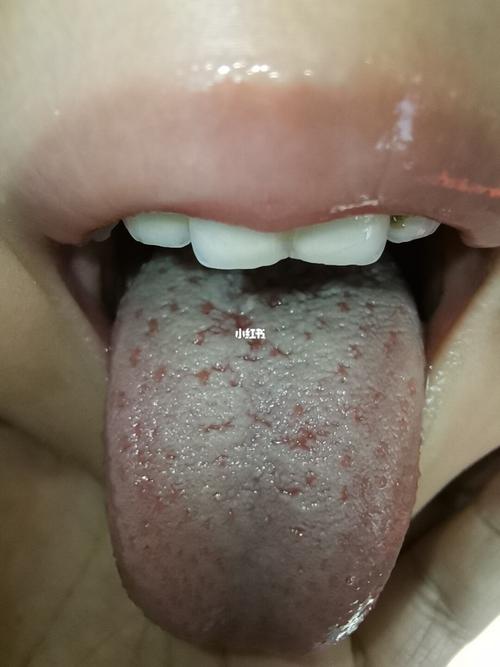 这个舌头正常吗?_母婴_育儿_母婴_育儿经验