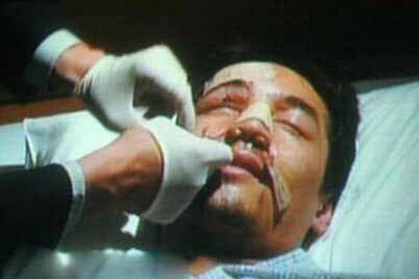 胡歌曾经出车祸毁容,现场照片惨不忍睹