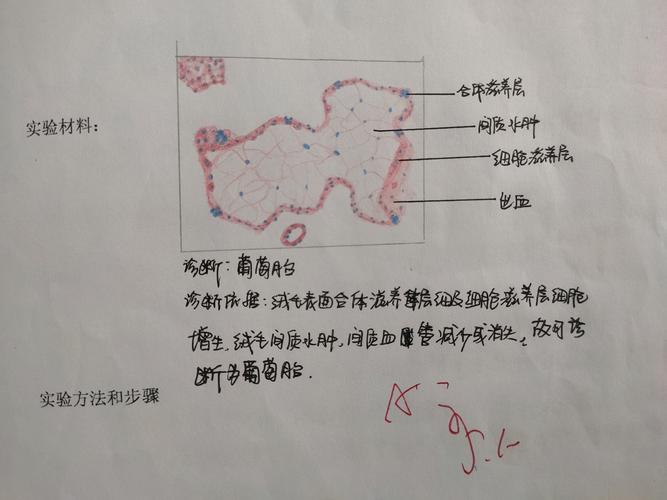病理学红蓝铅笔绘图