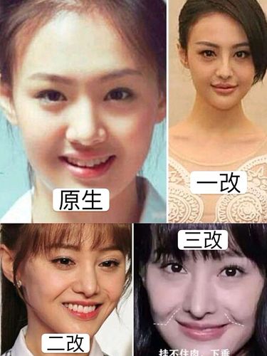 体验官x计划郑爽整形背后的人格变化史郑爽与张翰恋_圈子-新氧美容