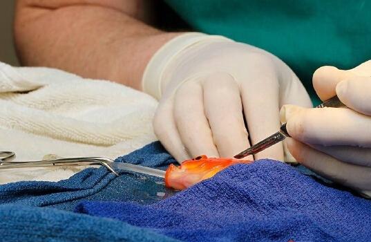 国外为什么都把系带切除了