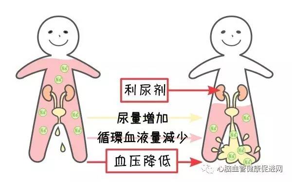 第780期|利尿剂降压留神四件事