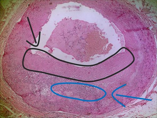 看图学病理循环系统第01部分