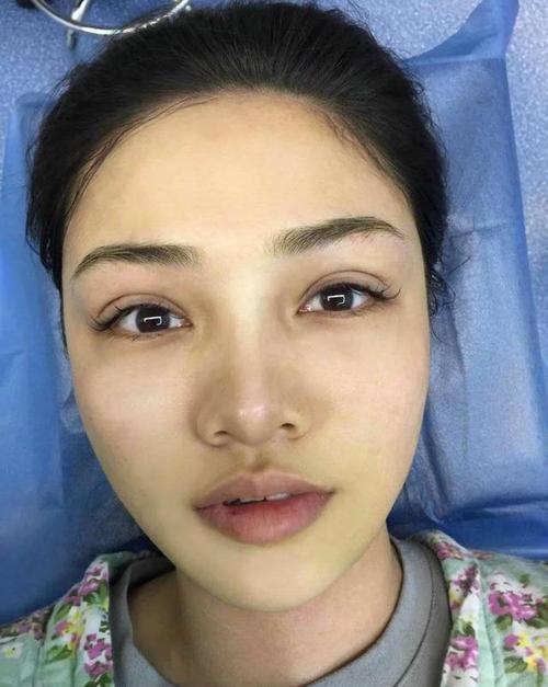 4种受欢迎的双眼皮形状,平行型公认最好看,平扇形颜值