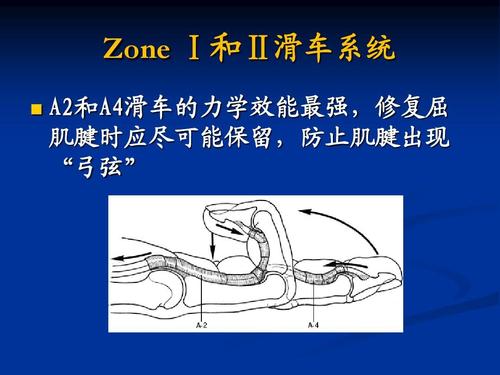 zone Ⅰ和Ⅱ滑车系统   a2和a4滑车的力学效能最强,修复屈 肌腱时应尽