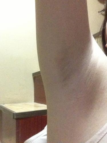 为什么有人腋毛多,有人腋下很干净?腋毛浓密与否,与什么有关