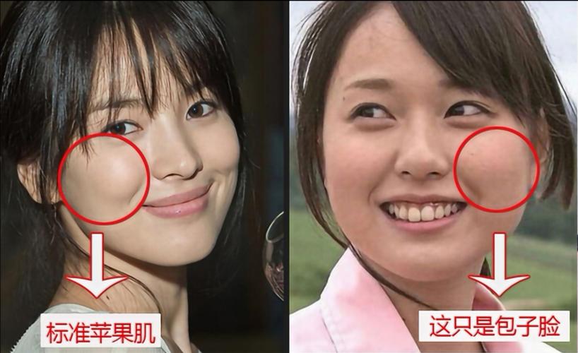 苹果肌还是高颧骨,包子脸傻傻的分不清!