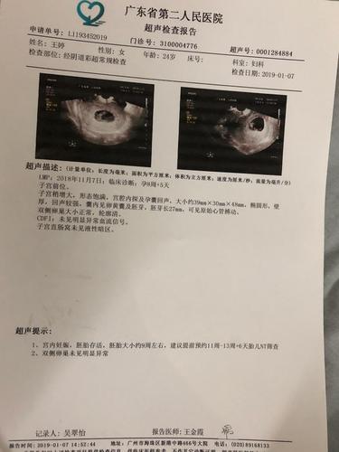 孕9周的肚子.宝宝快点长.一定要好好的