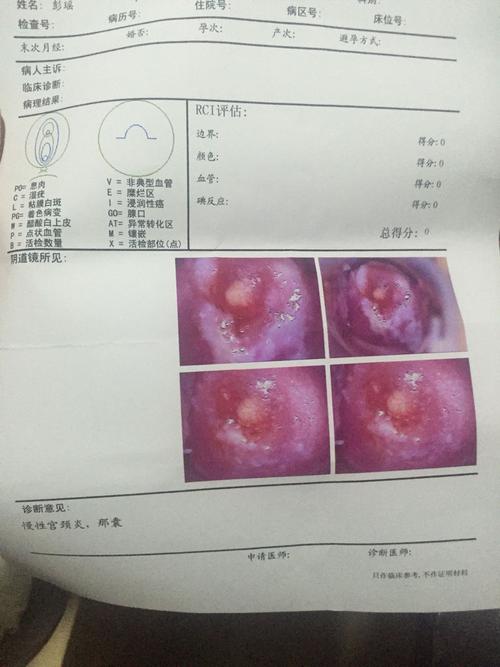 大姨妈推迟11天,昨天检查发现宫颈纳氏囊肿,子宫右附件囊肿,子宫内膜