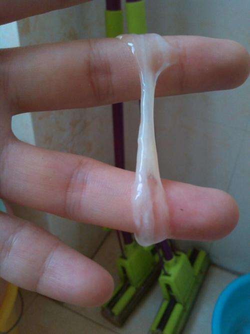 请问白带胶状条形,是排卵前,还是排卵后?急,谢啦