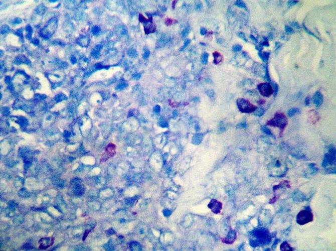肥大细胞甲苯胺蓝染液