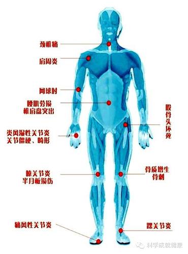 骨关节疾病好发部位