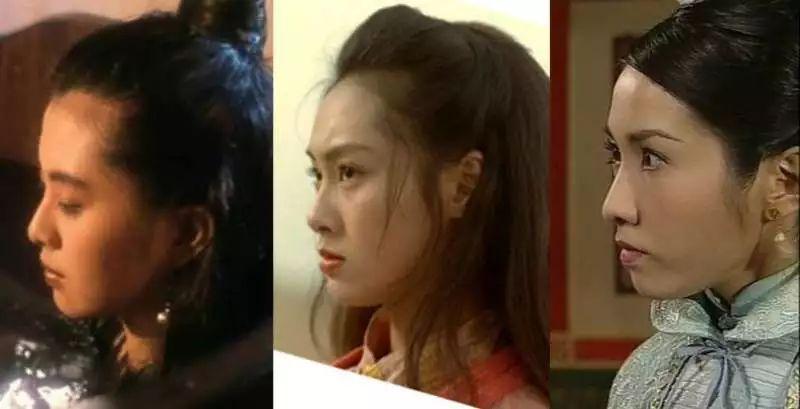 黎姿的凸主要是因为下巴后缩,显得嘴部前凸.