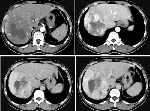 【科室风采】黑龙江省第二医院医学影像科256层ct简介