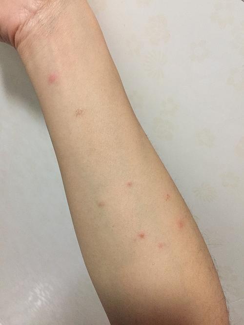 被主子传染了猫癣〒▽〒