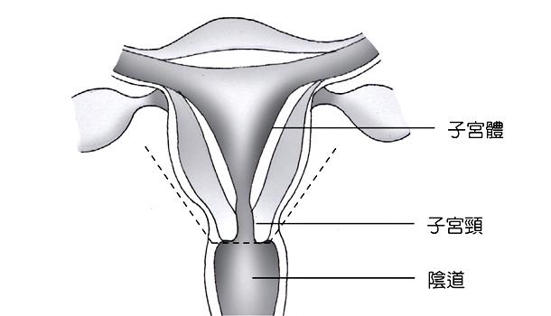 子宫切除后,会影响性生活吗?