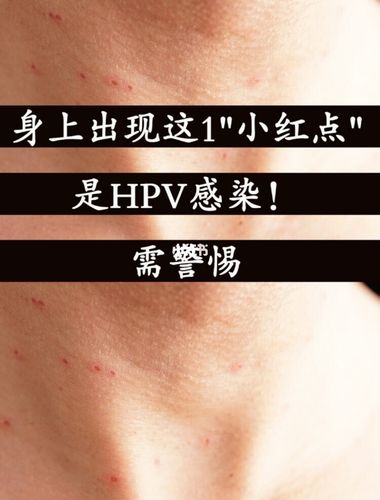 身上出现这1"小红点",是hpv感染!