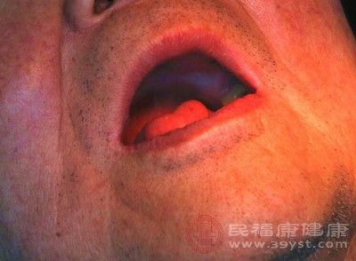 口腔癌的早期症状有这些症状当心口腔癌