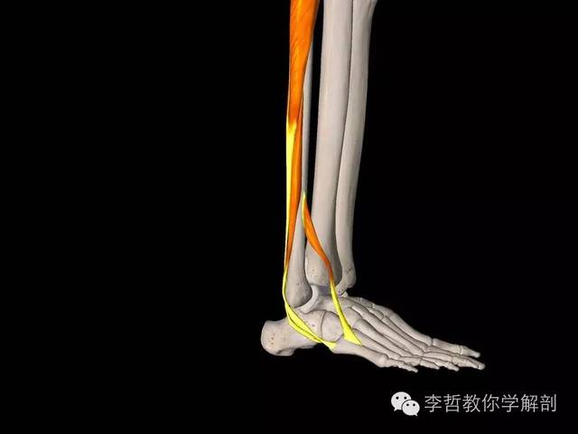 学员精彩笔记(10)| 你知道什么是莫顿足吗?