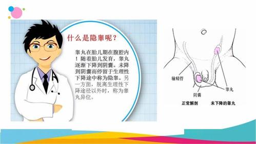 【唯爱儿科行 · 科普月月讲】儿童隐睾——迷失的"蛋蛋"